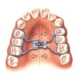 Expanders