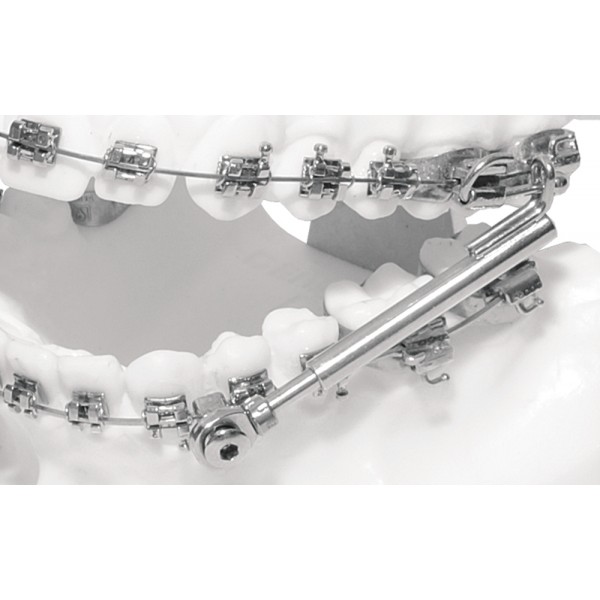 Set Sus² - 1 set