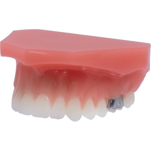Orthodontic Demonstration Model Tomas ® /Amda ®