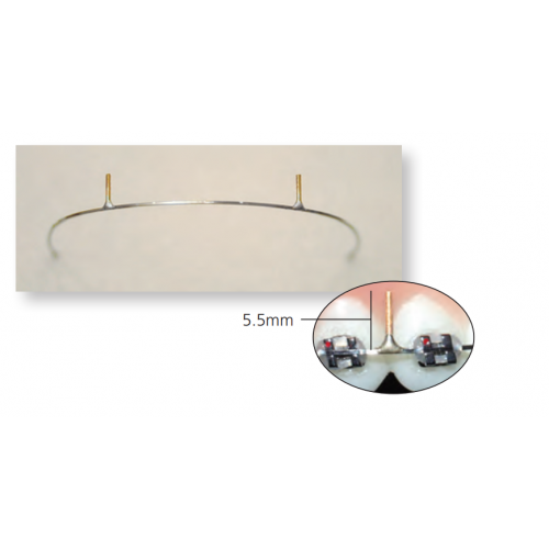 XR1 Universal Stainless Steel Straight Post - Rectangular Archwires (10/pk)