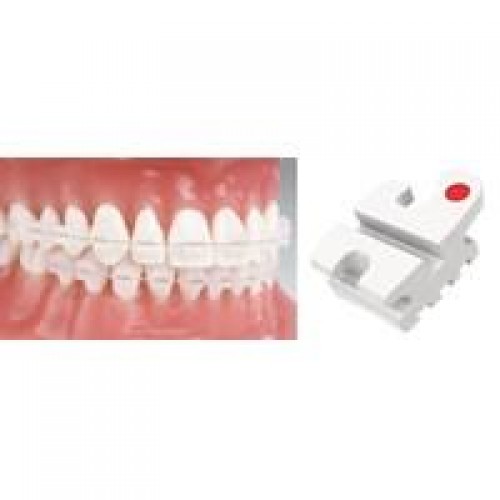 Reflections Roth RX V-Slot SPKS 10 Packs