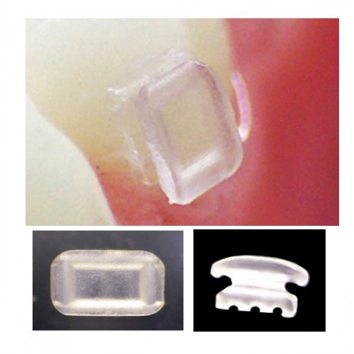 Avair Direct Bond Rectangular Button (10ct)